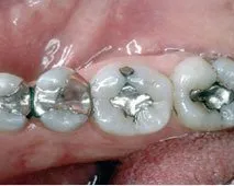 Before dental treatment