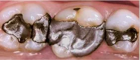 Before dental treatment