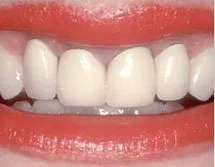 Before dental treatment