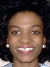 Before dental treatment