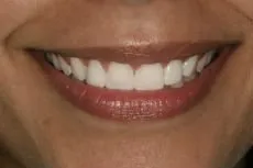 After dental treatment