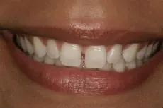 Before dental treatment