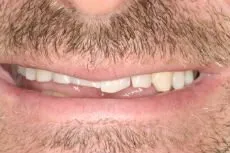 Before dental treatment